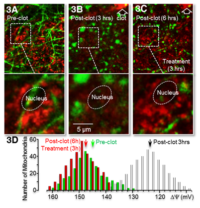 impact of single-vessel blood clots on neuronal morphology